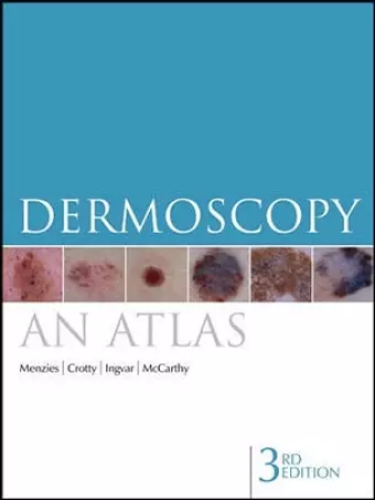 Dermoscopy cover