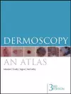 Dermoscopy cover