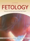 Fetology: Diagnosis and Management of the Fetal Patient, Second Edition cover