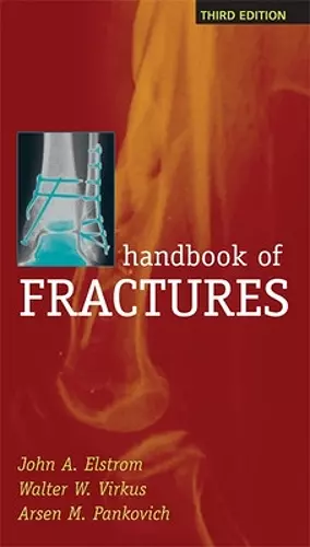 Handbook of Fractures, Third Edition cover