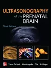 Ultrasonography of the Prenatal Brain, Third Edition cover