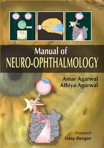 Manual of Neuro-Ophthalmology cover