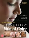 Taylor and Kelly's Dermatology for Skin of Color 2/E cover