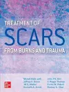 Treatment of Scars from Burns and Trauma cover