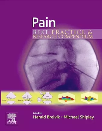 Pain cover