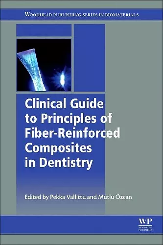 Clinical Guide to Principles of Fiber-Reinforced Composites in Dentistry cover