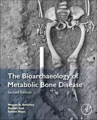 The Bioarchaeology of Metabolic Bone Disease cover