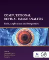 Computational Retinal Image Analysis cover