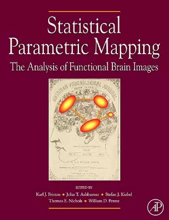 Statistical Parametric Mapping: The Analysis of Functional Brain Images cover