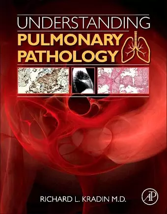 Understanding Pulmonary Pathology cover