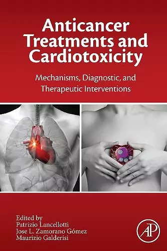 Anticancer Treatments and Cardiotoxicity cover