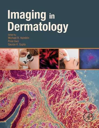 Imaging in Dermatology cover