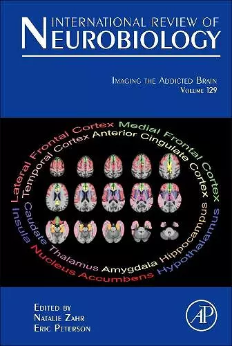 Imaging the Addicted Brain cover