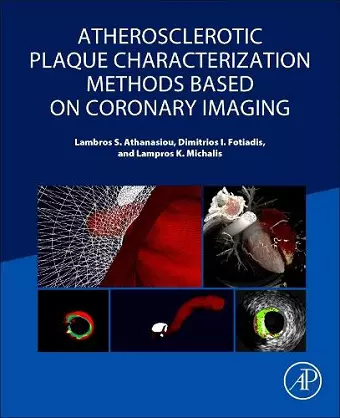 Atherosclerotic Plaque Characterization Methods Based on Coronary Imaging cover