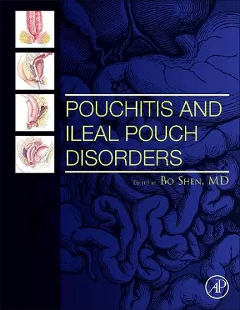 Pouchitis and Ileal Pouch Disorders cover