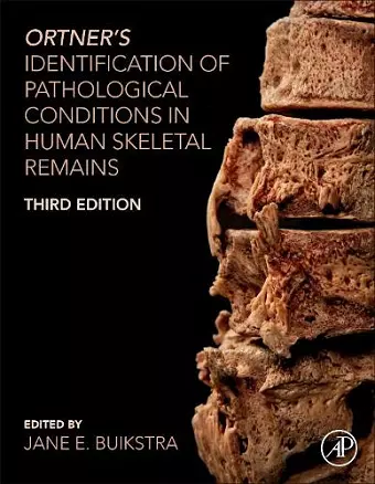 Ortner's Identification of Pathological Conditions in Human Skeletal Remains cover