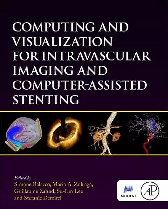 Computing and Visualization for Intravascular Imaging and Computer-Assisted Stenting cover