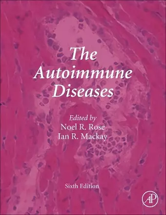 The Autoimmune Diseases cover