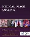 Medical Image Analysis cover