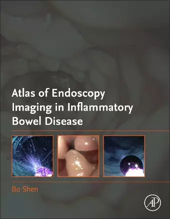 Atlas of Endoscopy Imaging in Inflammatory Bowel Disease cover