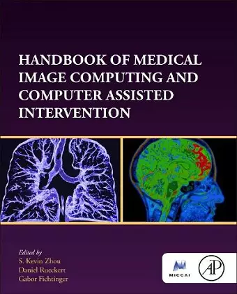 Handbook of Medical Image Computing and Computer Assisted Intervention cover