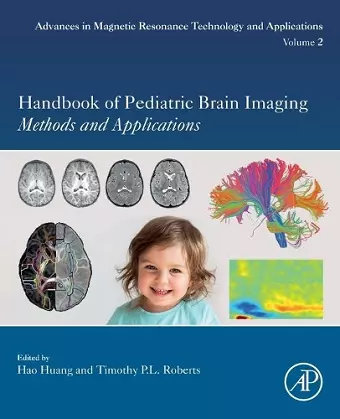 Handbook of Pediatric Brain Imaging cover