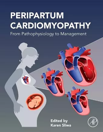 Peripartum Cardiomyopathy cover