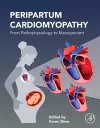 Peripartum Cardiomyopathy cover