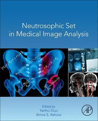 Neutrosophic Set in Medical Image Analysis cover