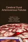 Cerebral Dural Arteriovenous Fistulas cover