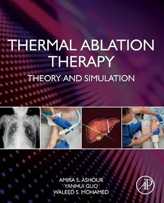 Thermal Ablation Therapy cover