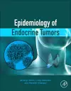 Epidemiology of Endocrine Tumors cover