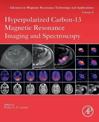 Hyperpolarized Carbon-13 Magnetic Resonance Imaging and Spectroscopy cover