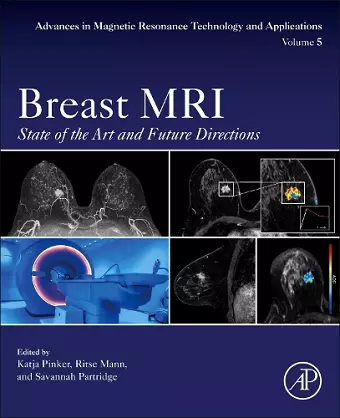 Breast MRI cover