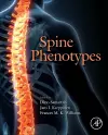 Spine Phenotypes cover