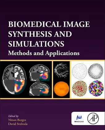 Biomedical Image Synthesis and Simulation cover