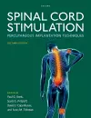 Spinal Cord Stimulation cover