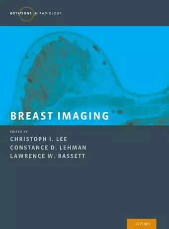 Breast Imaging cover