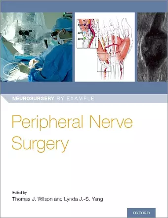 Peripheral Nerve Surgery cover