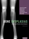 Bone Dysplasias cover