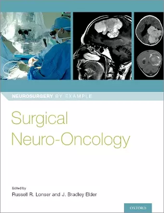 Surgical Neuro-Oncology cover