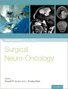 Surgical Neuro-Oncology cover