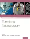 Functional Neurosurgery cover