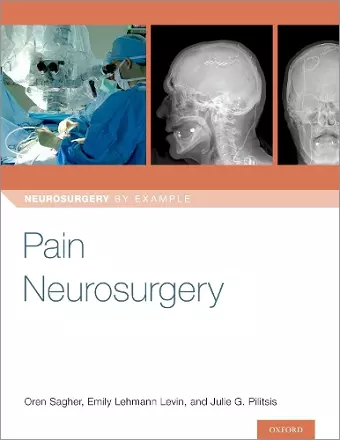 Pain Neurosurgery cover