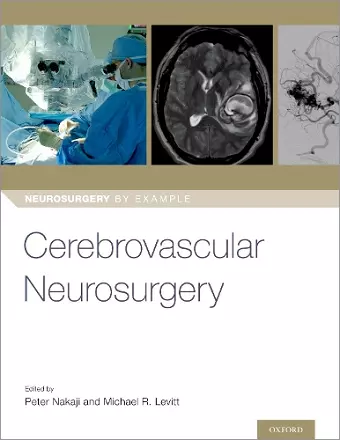 Cerebrovascular Neurosurgery cover