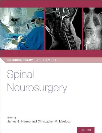 Spinal Neurosurgery cover