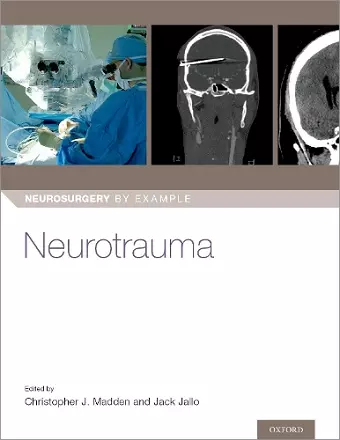 Neurotrauma cover