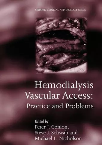 Hemodialysis Vascular Access cover