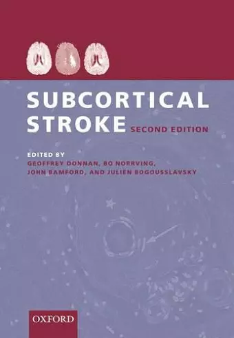 Subcortical Stroke cover