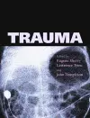 Trauma cover